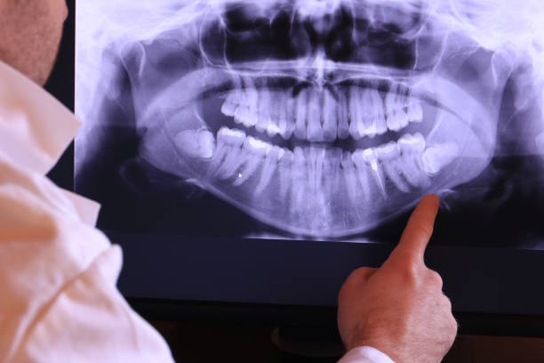 Best Holiday Emergency Dentist in Lford, MI