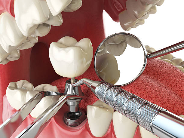 Best Orthodontic Emergency Dentist in Lford, MI