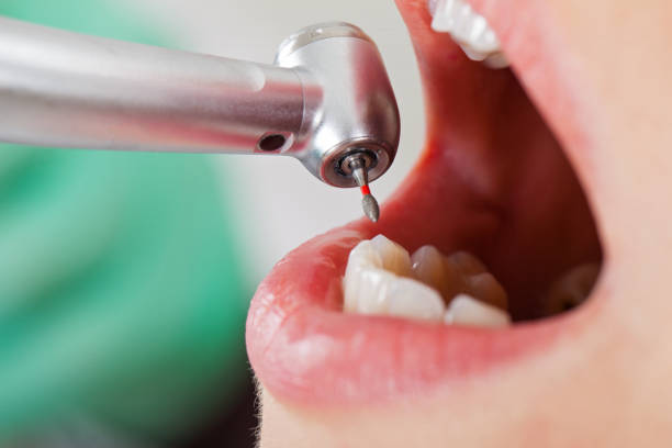 Best Pediatric Emergency Dentist in Lford, MI